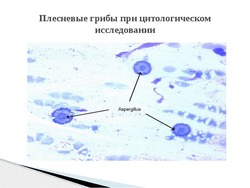 Плесневые грибы при цитологическом исследовании Плесневые грибы при цитологическом исследовании