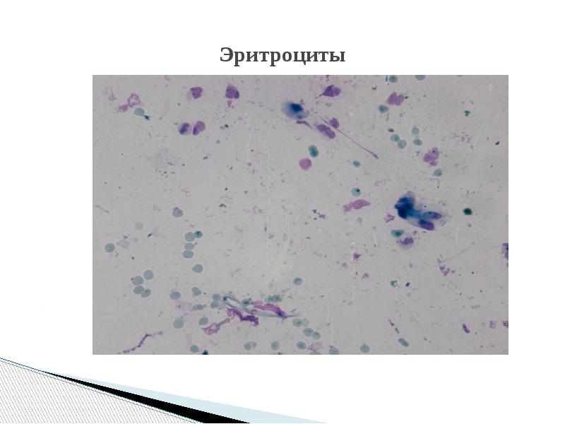 Эритроциты Эритроциты