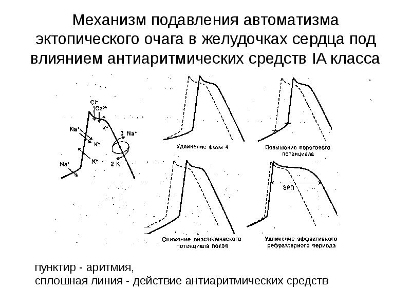 Антиаритмические препараты презентация