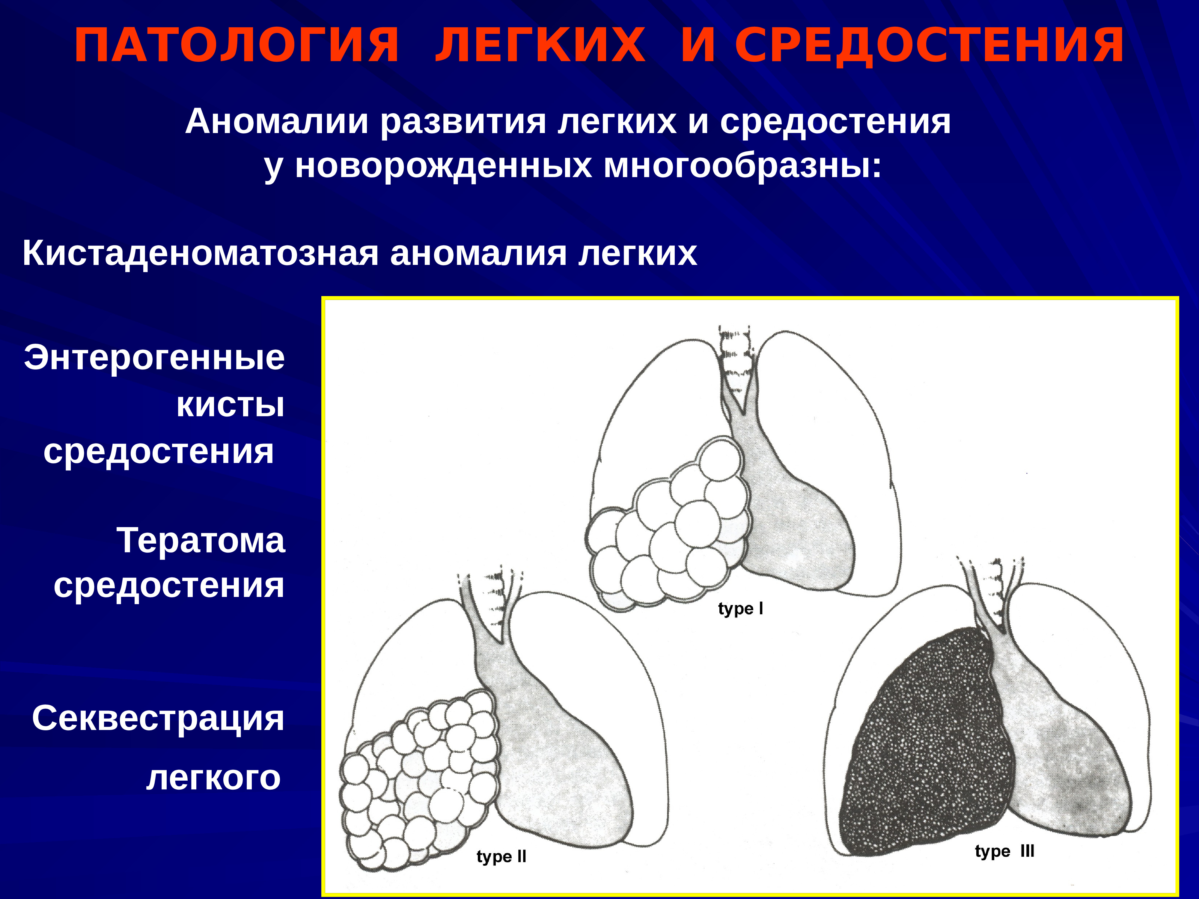 Врожденные пороки развития дыхательной системы презентация