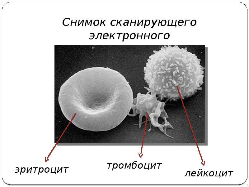 Сканирующая электронная микроскопия. Растровая (сканирующая) электронная микроскопия. Сканирующая электронная микроскопия микроскоп. Сканирующий электронный микроскоп снимки.