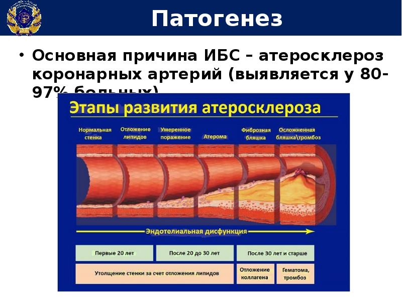 Атеросклероз презентация по терапии