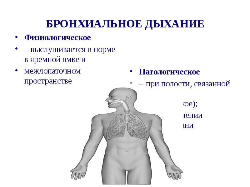 Бронхиальное дыхание выслушивается. Бронхиальное дыхание. Физиологическое бронхиальное дыхание. Бронхиальное дыхание в норме. Места выслушивания бронхиального дыхания.