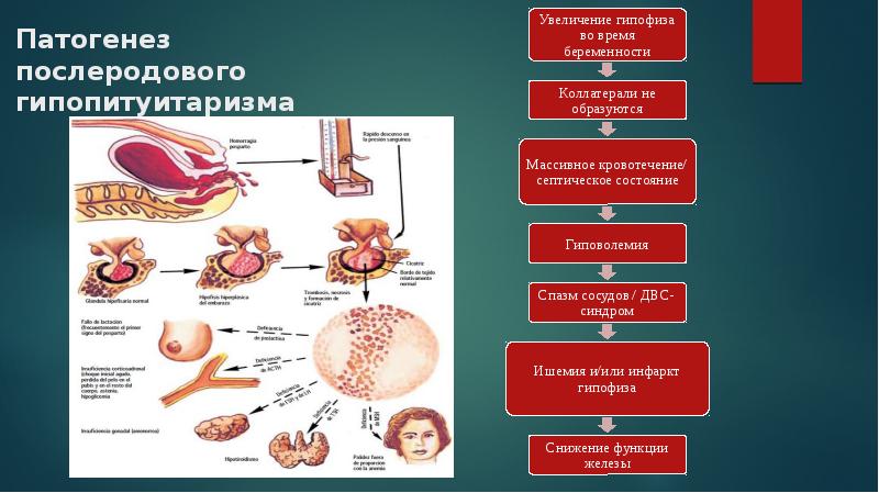 Послеродовый нейроэндокринный синдром презентация