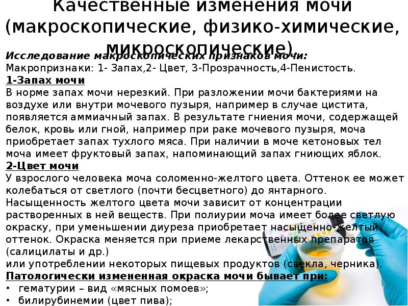 Качественные изменения мочи (макроскопические, физико-химические, микроскопические).
