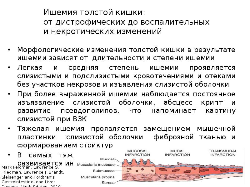 Ишемия кишечника лечение препараты схема