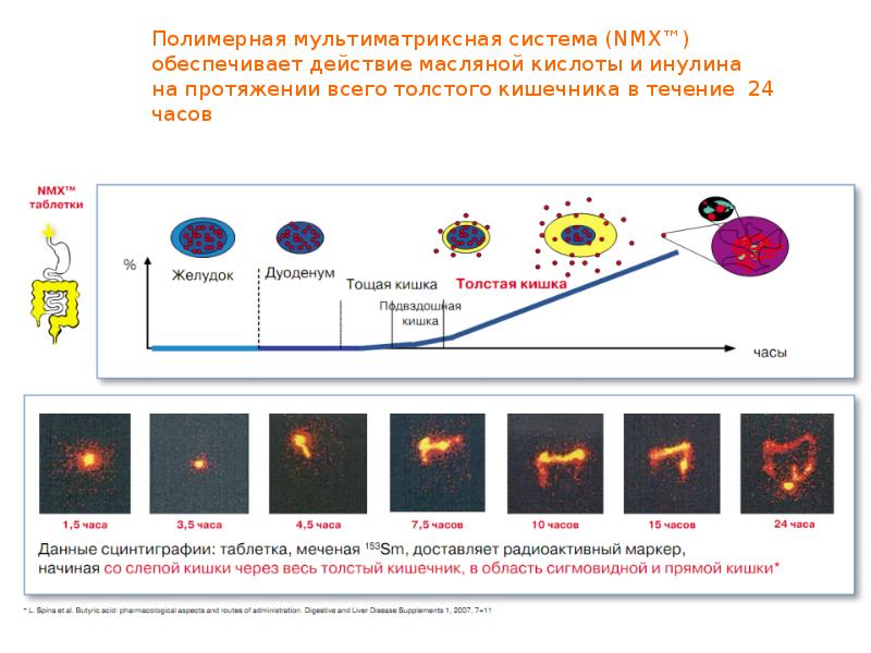 Ишемический колит презентация