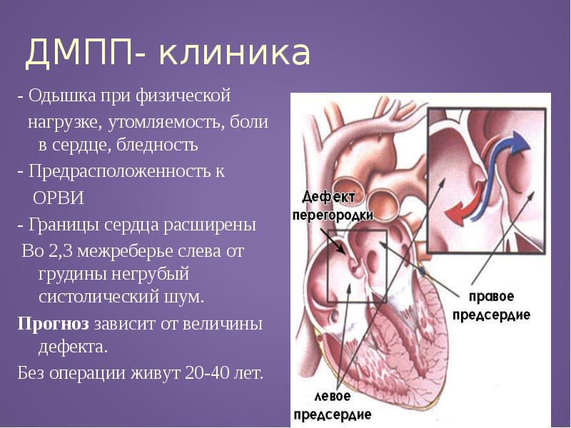 Впс у детей презентация