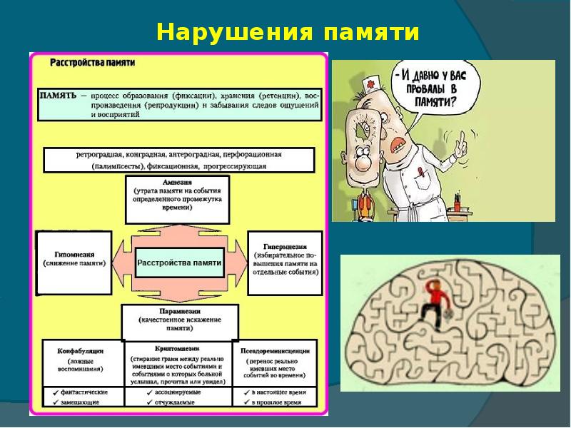 Нарушения памяти схема