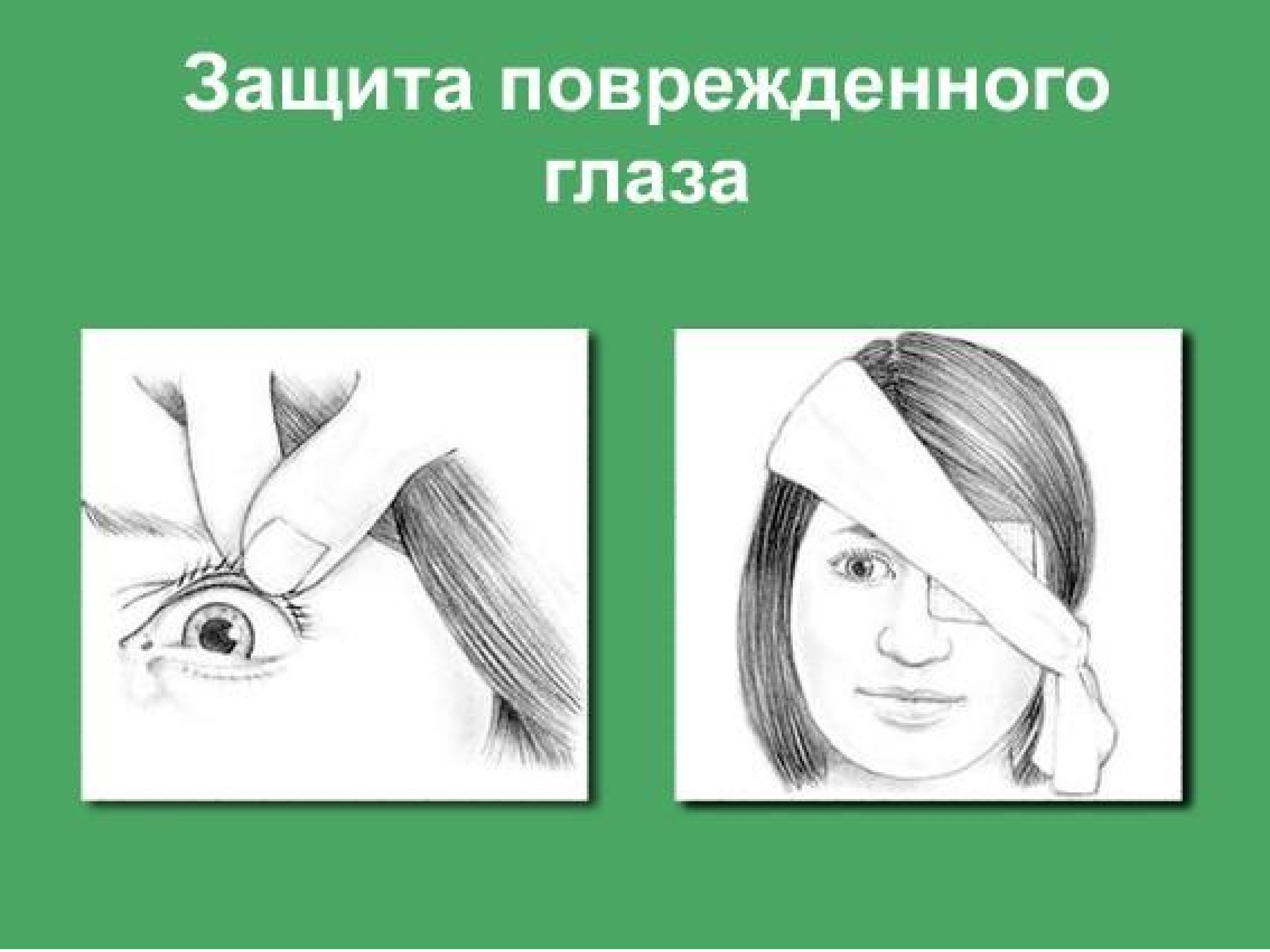 Защита травмированного глаза. Защищают от повреждений и тем. Механизмы защиты и адаптации клеток при повреждающих воздействиях. Защищают от повреждений и тем. Какой орган защищает от жары и холода 3 класс.