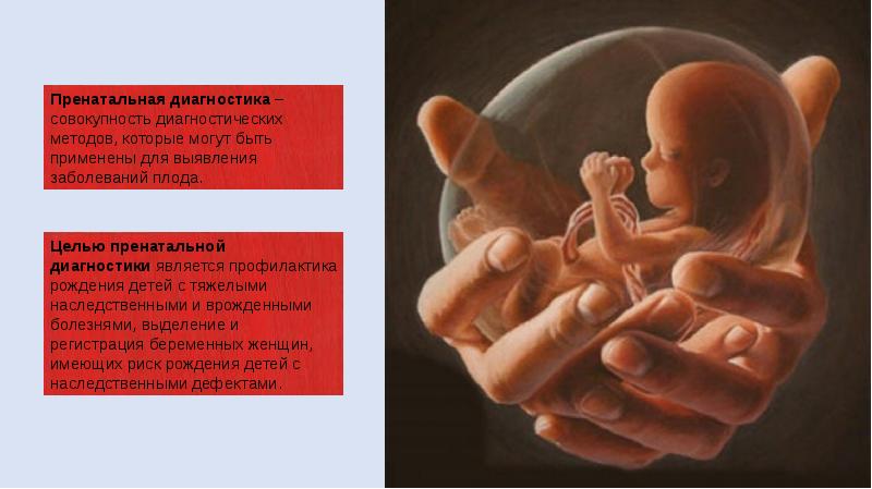 Пренатальная диагностика презентация