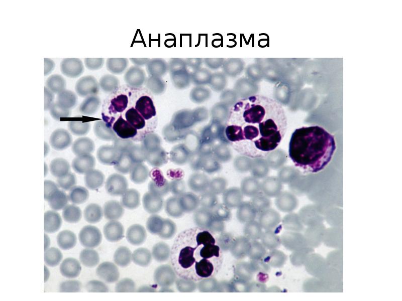 Эрлихиоз человека встречаемости.