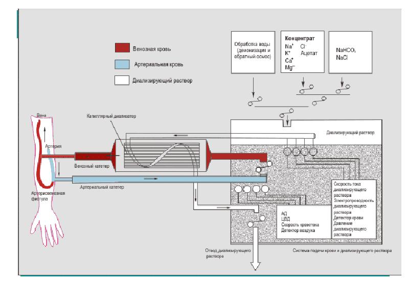 Принцип работы аппарата искусственная почка рисунок