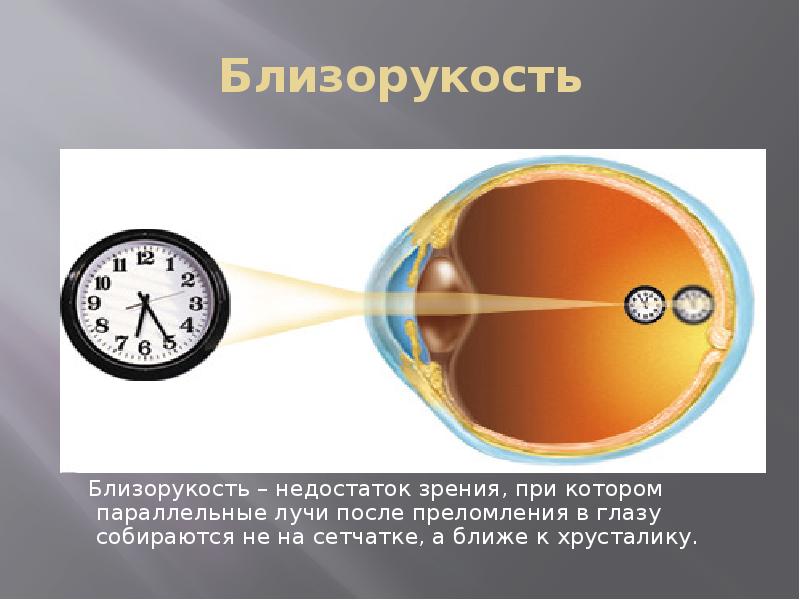 Глаз зрение физика презентация