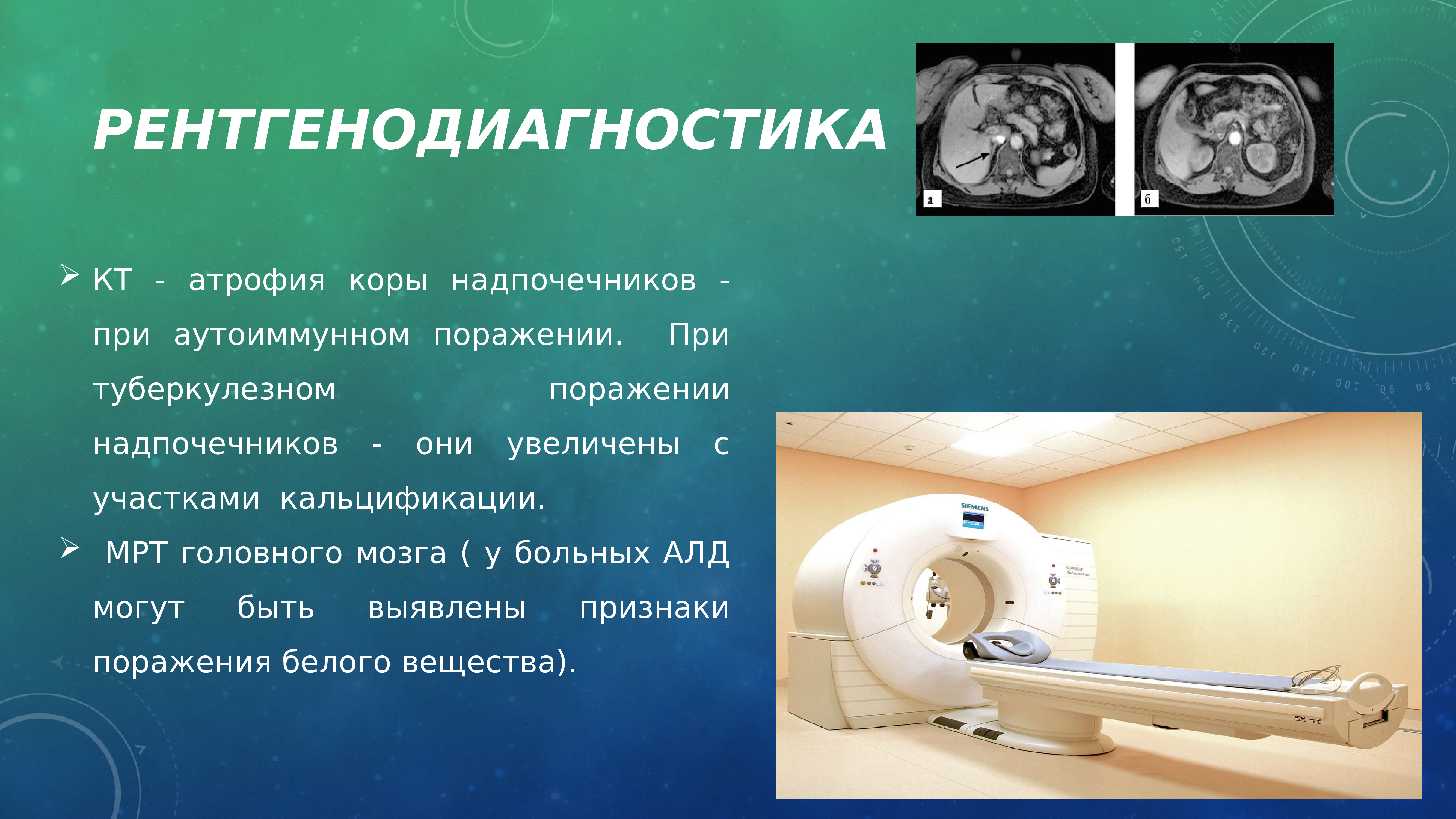 Подготовка к кт надпочечников