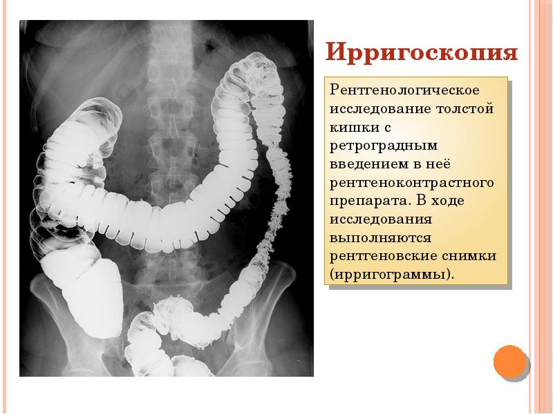 Заболевания пищеварительной системы презентация