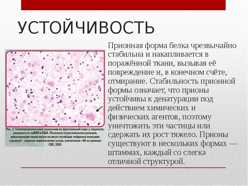 Пораженная ткань