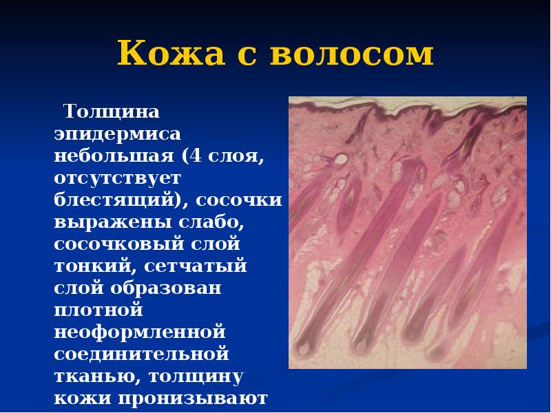 Кожа с волосом    Толщина эпидермиса небольшая (4 слоя,