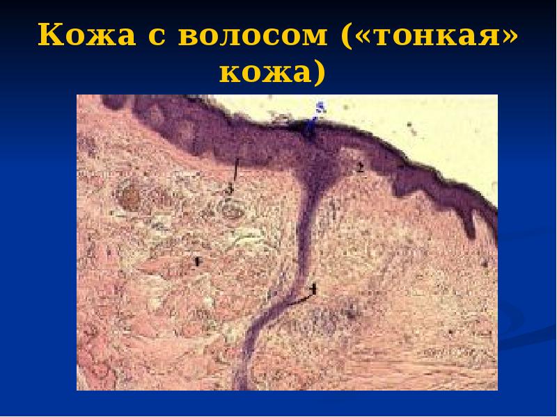 Кожа с волосом («тонкая» кожа)