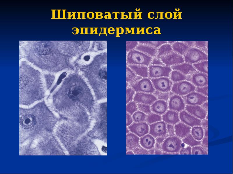 Шиповатый слой эпидермиса