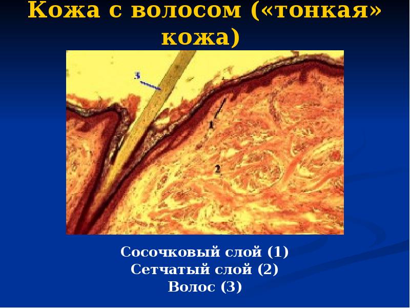 Кожа с волосом («тонкая» кожа)  Сосочковый слой (1) Сетчатый слой