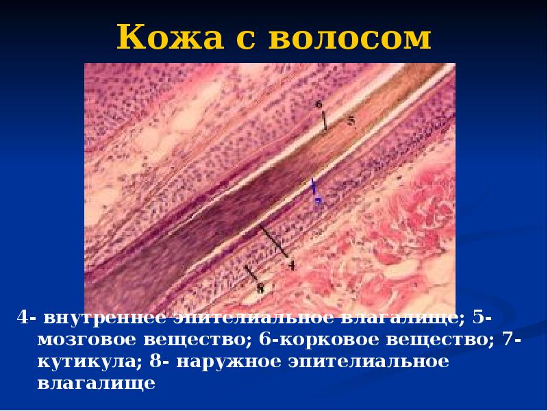 Кожа с волосом 4- внутреннее эпителиальное влагалище; 5-мозговое вещество; 6-корковое вещество;