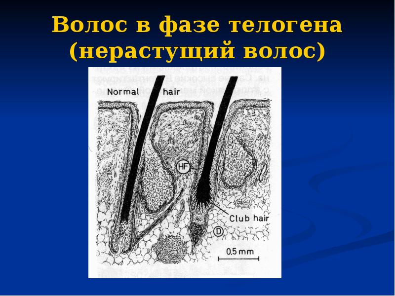 Волос в фазе телогена (нерастущий волос)