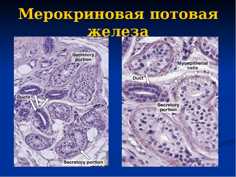 Мерокриновая потовая железа