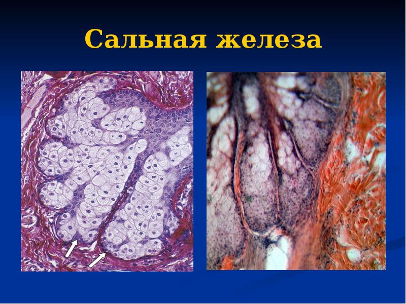 Сальная железа