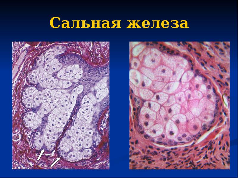 Сальная железа