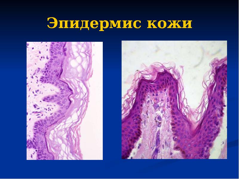 Эпидермис кожи