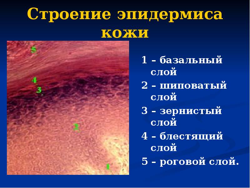 Строение эпидермиса кожи 1 – базальный слой 2 – шиповатый слой