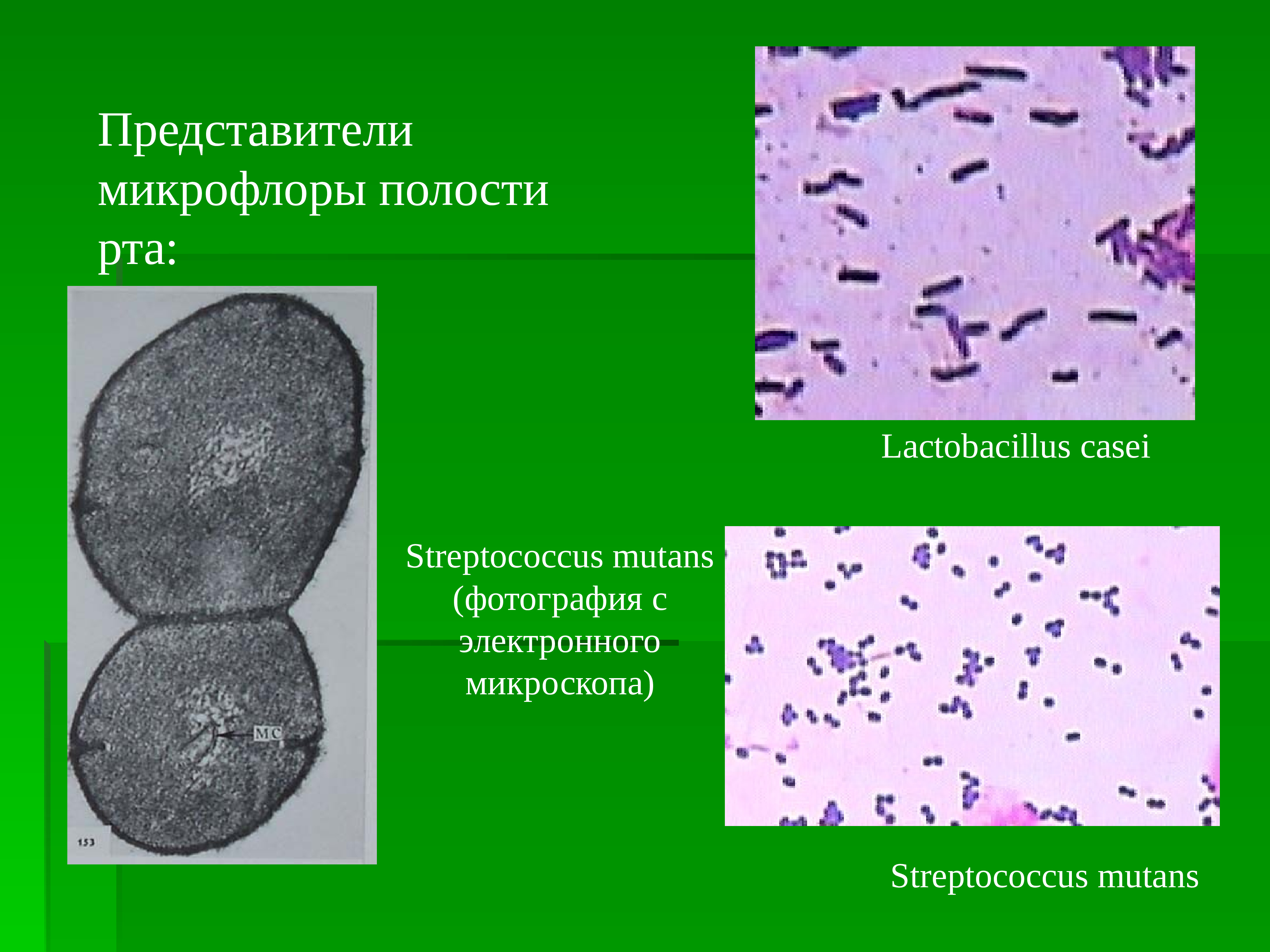 Микроорганизмы полости рта. Представители микрофлоры ротовой полости. Микрофлора полости рта микробиология. Микрофлора зубного налета микробиология.
