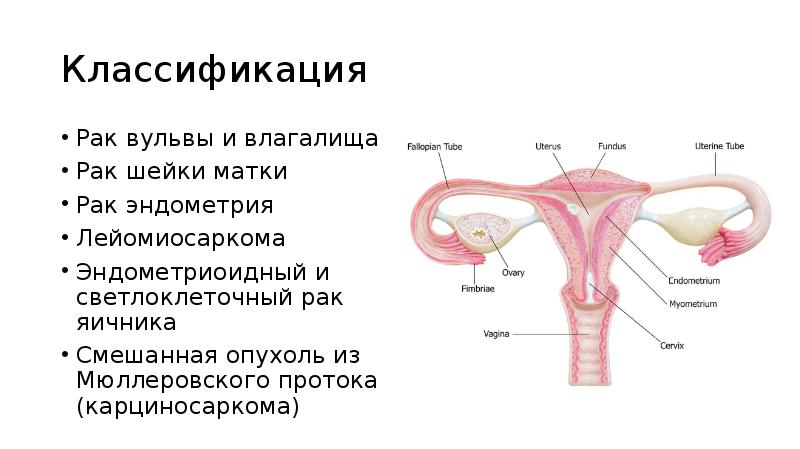 Классификация
Рак вульвы и влагалища
Рак шейки матки
Рак эндометрия
Лейомиосаркома
Классификация
Рак вульвы и влагалища
Рак шейки матки
Рак эндометрия
Лейомиосаркома