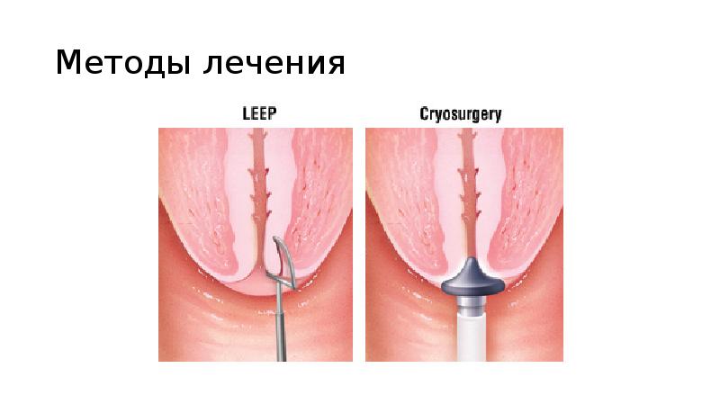 Методы лечения Методы лечения
