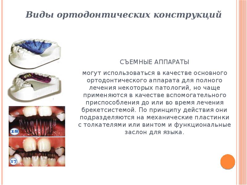 Хирургические методы в плане комплексного ортодонтического лечения