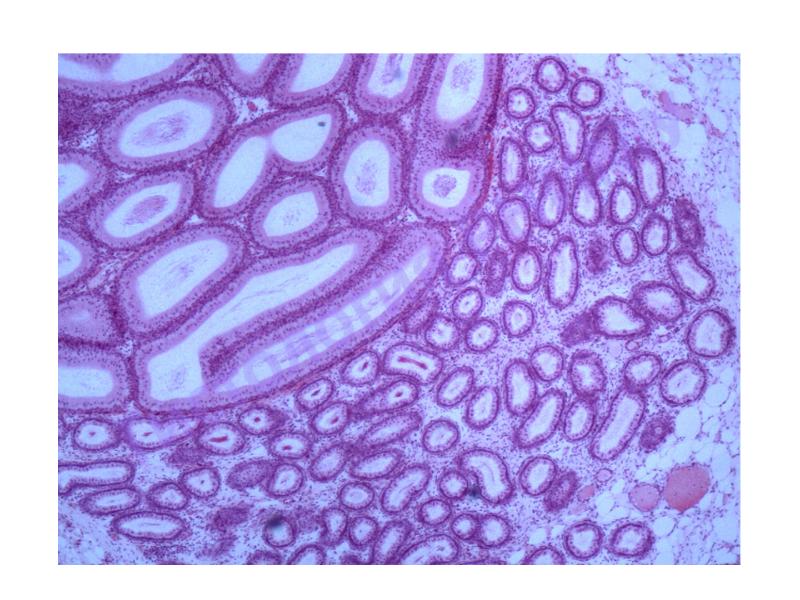 Придаток семенника рисунок гистология