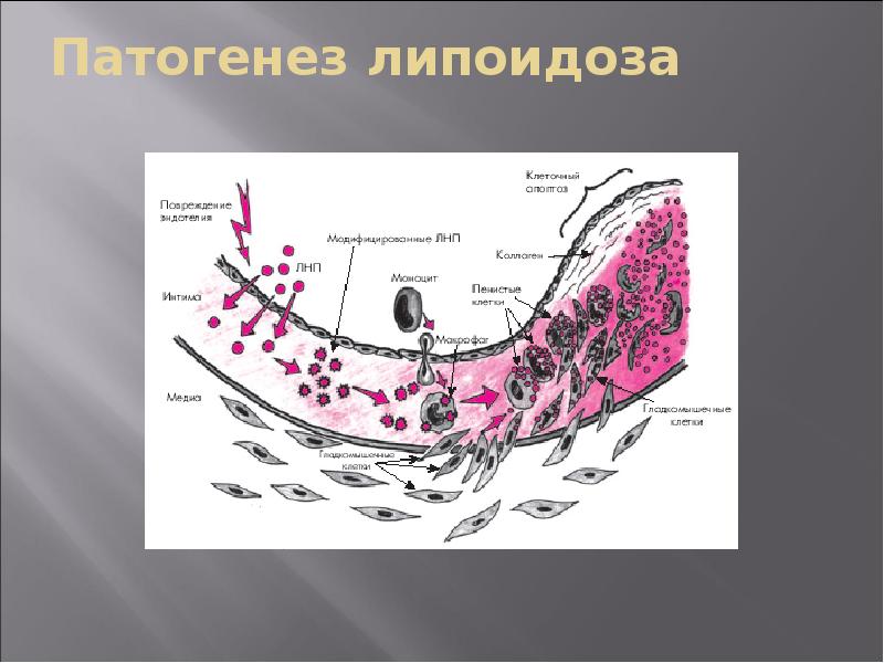 Патофизиология атеросклероза презентация