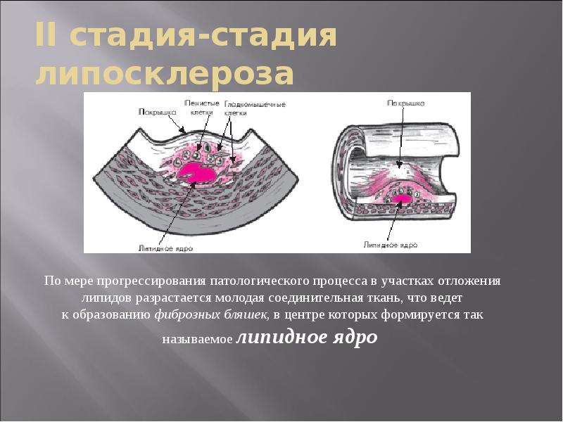 Атеросклероз патофизиология презентация