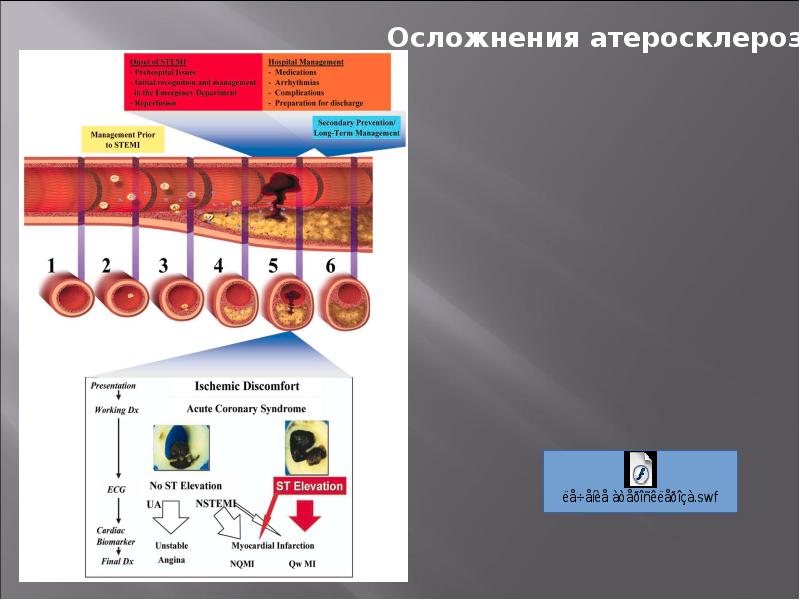 Осложнения атеросклероза. Осложнения атеросклероза нижних конечностей. Патогенез атеросклероза.