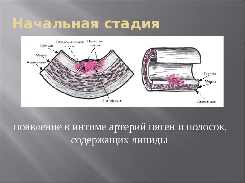 Атеросклероз патофизиология презентация