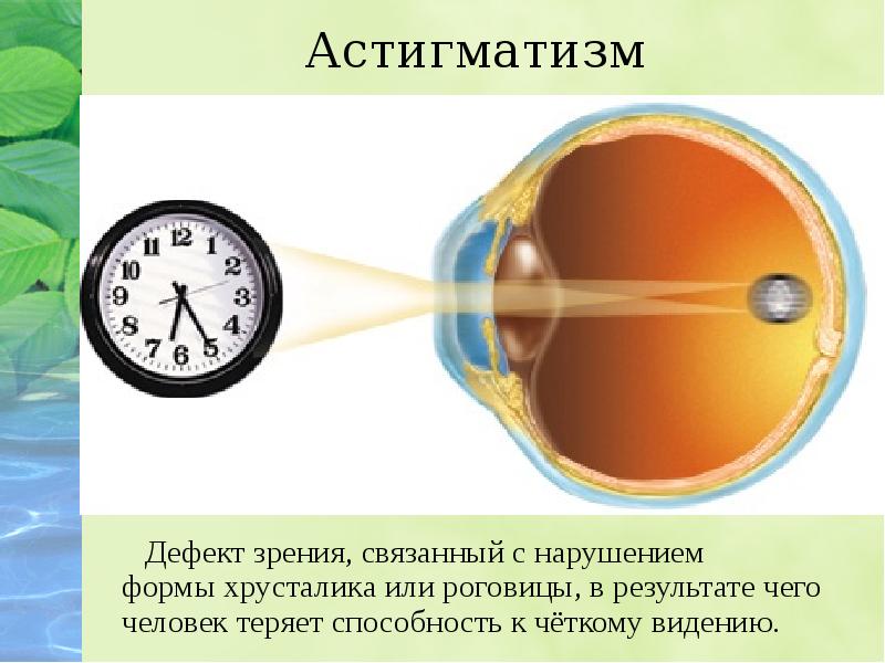 Дефекты зрения презентация по физике