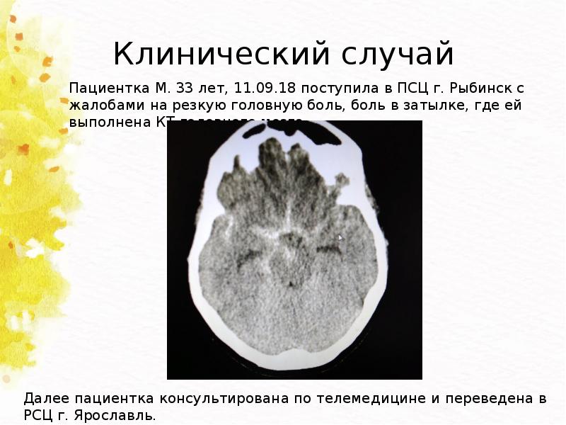 Разбор клинического случая презентация