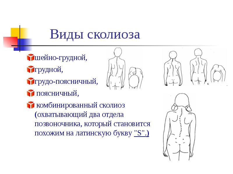 В каких плоскостях бывает ротация сколиоза