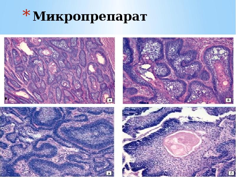 Рисунки микропрепаратов по патанатомии