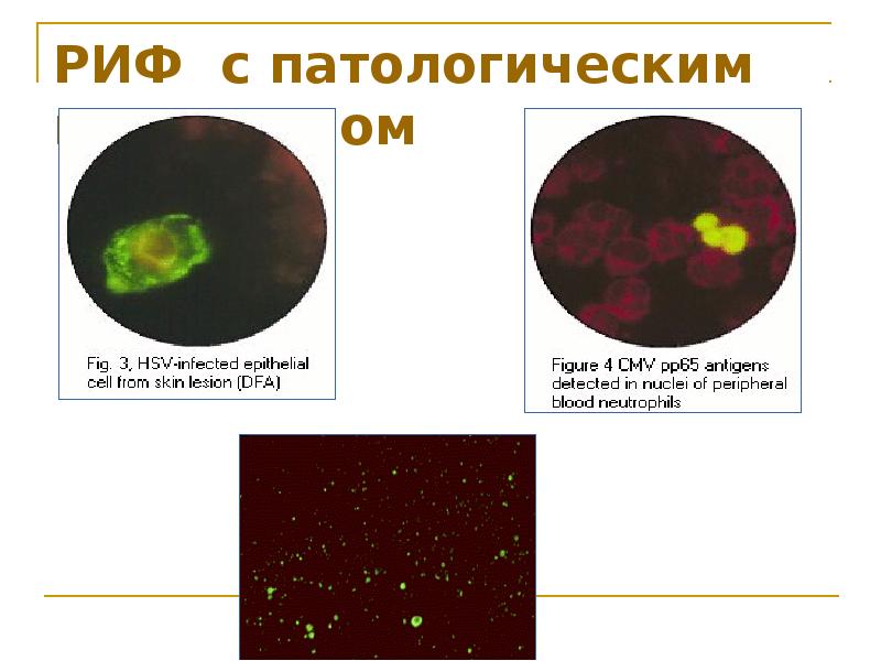 Кровяное давление для презентации. Катер риф-75 пк 3. Манометр arb с дефлятором. Формула избыточного гидростатического давления. Гидростатическое и онкотическое давление физиология.