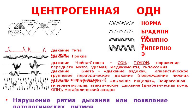 Острая дыхательная недостаточность презентация