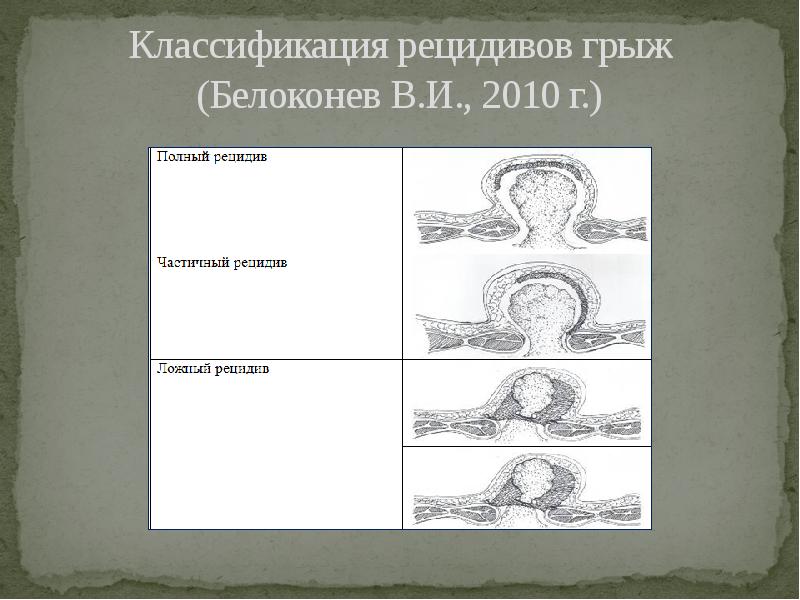 Полный рецидив