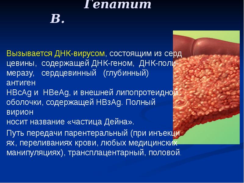 Гепатит В.
Вызывается ДНК-вирусом, состоящим из серд цевины, содержащей ДНК-геном, ДНК-поли- Гепатит В.
Вызывается ДНК-вирусом, состоящим из серд цевины, содержащей ДНК-геном, ДНК-поли-