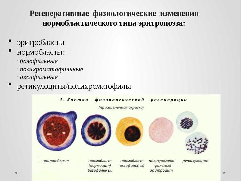 Регенеративные физиологические изменения нормобластического типа эритропоэза: Регенеративные физиологические изменения нормобластического типа